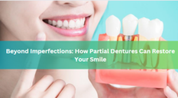 Beyond Imperfections: How Partial Dentures Can Restore Your Smile