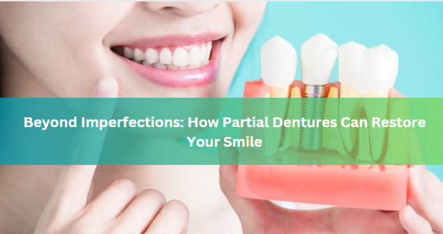 Beyond Imperfections: How Partial Dentures Can Restore Your Smile